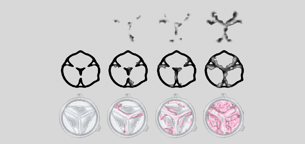 improved-diagnostics-presurgical-planning-high-resolution-functionally-graded-multi-material-3d-printing-biomedical-tomographic-datasets-9 improved-diagnostics-presurgical-planning-high-resolution-functionally-graded-multi-material-3d-printing-biomedical-tomographic-datasets-9